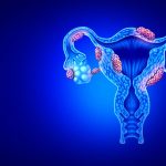 Gilios endometriozės