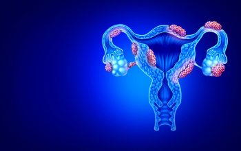 Gilios endometriozės