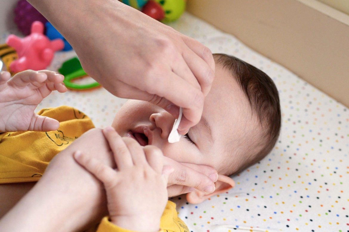 Rozeola jaundzimušajiem: simptomi, cēloņi un ārstēšana

**Piezīme:** Ja “rožinė akis” ir domāta kā medicīnisks termins, tas lietuvas valodā apzīmē “konjunktivītu” jeb “rozā aci” (rožaina acs). Ja konteksts ir oftalmoloģisks, precīzāk būtu:

**Konjunktivīts jaundzimušajiem: simptomi, cēloņi un ārstēšana**