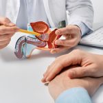 Padidėjusios prostatos gydymas ir jūsų seksualinis gyvenimas