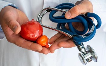 Prostatos biopsija