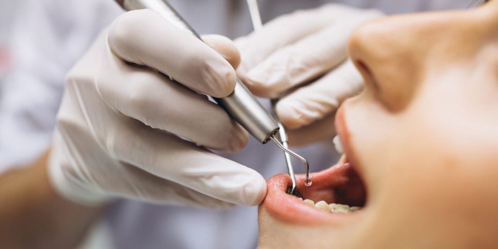 Zobārstniecības procedūras, kas palīdz uzturēt nevainojamu zobu veselību