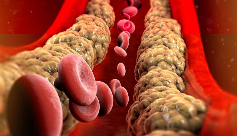 Cholesterolis