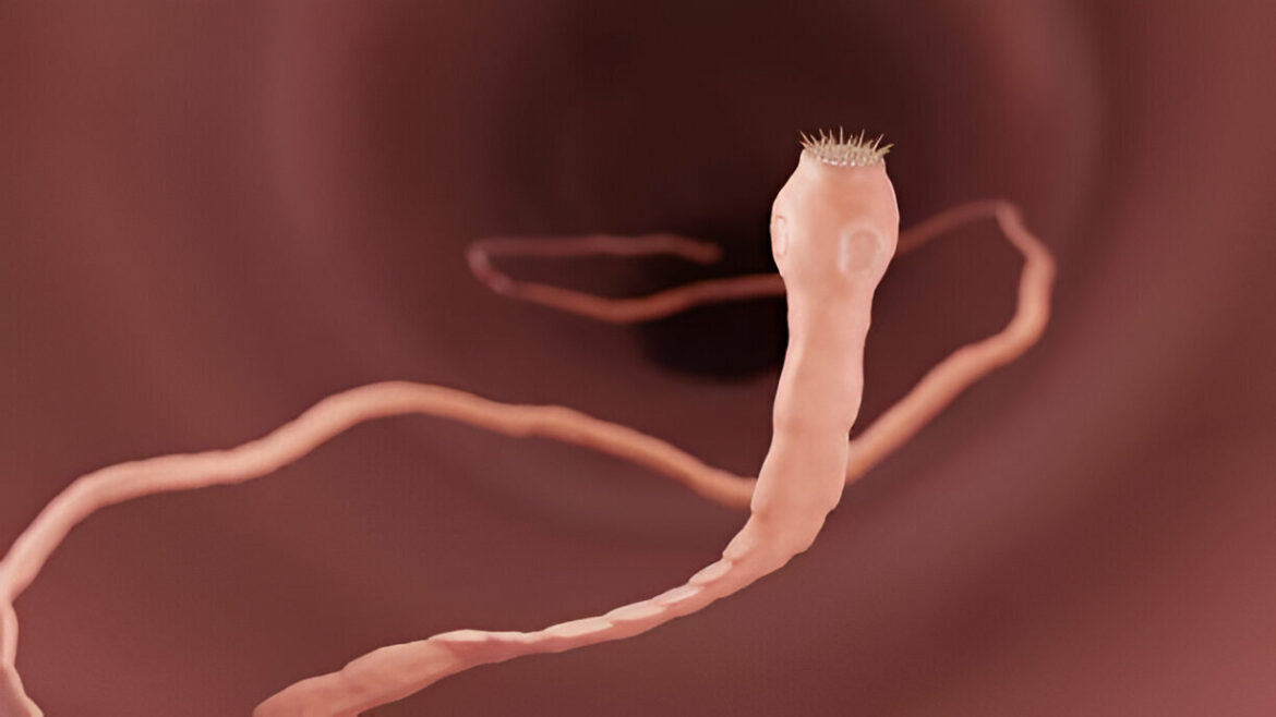 Kaspinuočio infekcija: simptomai ir gydymas

latviski:

Lentēriepju infekcija: simptomi un ārstēšana

**Paskaidrojums:**  
– “Kaspinuotis” lietuviešu valodā apzīmē lenteni jeb lenttārpu (piemēram, _Taenia_ spp.) — vispārpieņemtais medicīniskais termins latviešu valodā ir “lentēris” vai “lentene”. Drošākais un vispārīgākais apzīmējums infekcijai ir “lentēriepju infekcija”.
– “Simptomai” — “simptomi”
– “Gydymas” — “ārstēšana”

**Ja nepieciešama ļoti populārzinātniska versija:**  
Lentenu infekcija: simptomi un ārstēšana