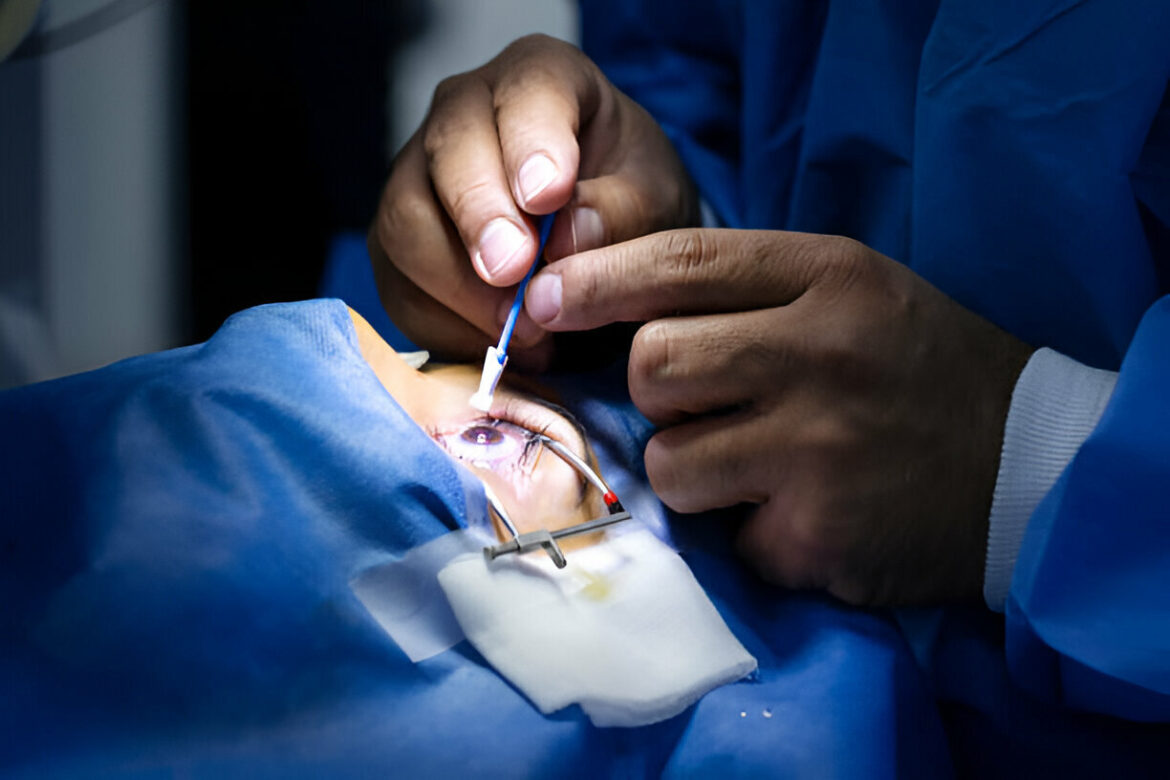LASIK acu ķirurģija: faktori, kas jāņem vērā