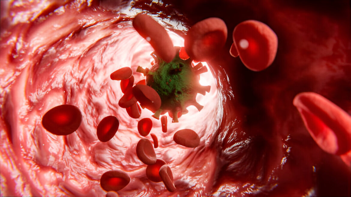 Termins “neutrofilai” visticamāk radies no angļu valodas termina **neutrophilia**, kas apzīmē stāvokli, kad asinīs ir paaugstināts neitrofilo leikocītu (neitrofilu) skaits.

Latviešu valodā pareizais medicīniskais termins ir:

**neitrofīlija**

Papildu skaidrojums:
– “neitrofīlija” – paaugstināts neitrofilu skaits asinīs.

Tātad, “neutrofilai” korekti un terminoloģiski pareizi tulko kā **neitrofīlija**.