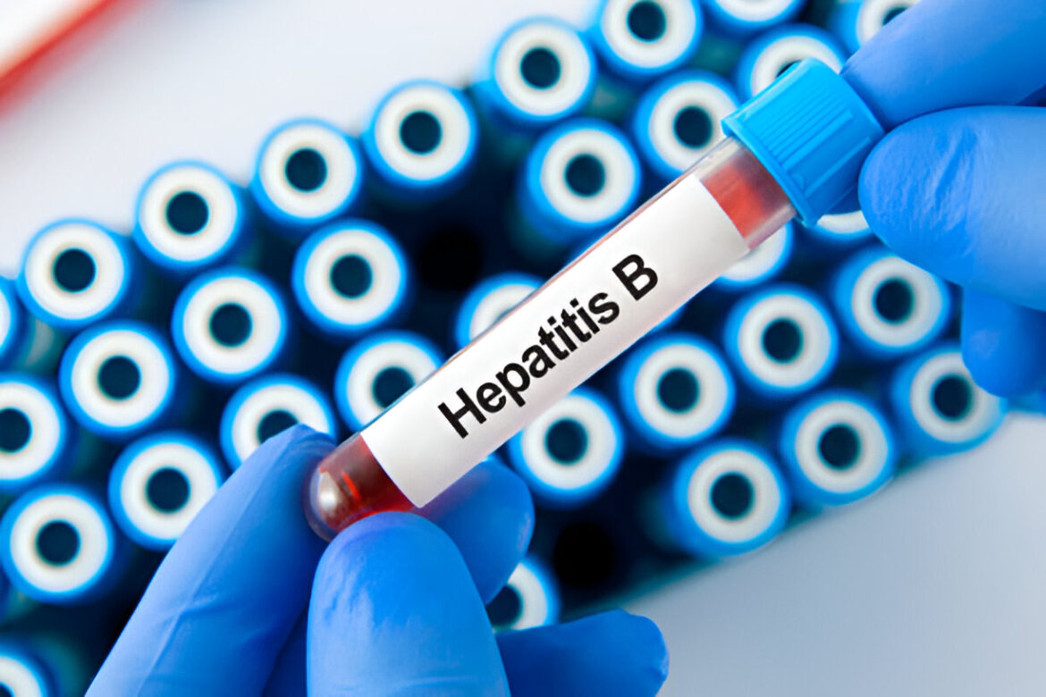 B hepatīts