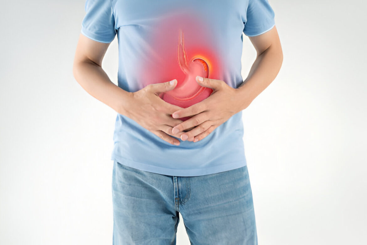 Kuņģa čūla pazīmes, izcelsme, diagnoze un terapija