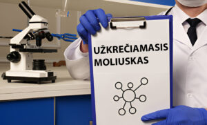 uzkreciamasis-moliuskas