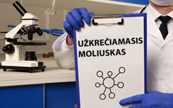 uzkreciamasis-moliuskas