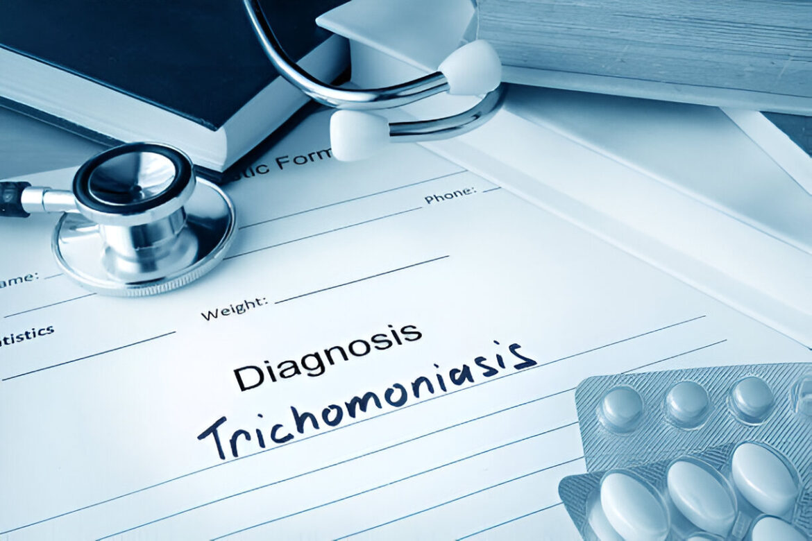 Trichomonozė (lietuviešu val.) jālatvisko kā **trihomonoze**.

Šis ir medicīnisks termins, kas apzīmē seksuāli transmisīvu slimību, ko izraisa vienšūnis *Trichomonas vaginalis*. Latviešu valodā plaši tiek lietots termins **trihomonoze**.