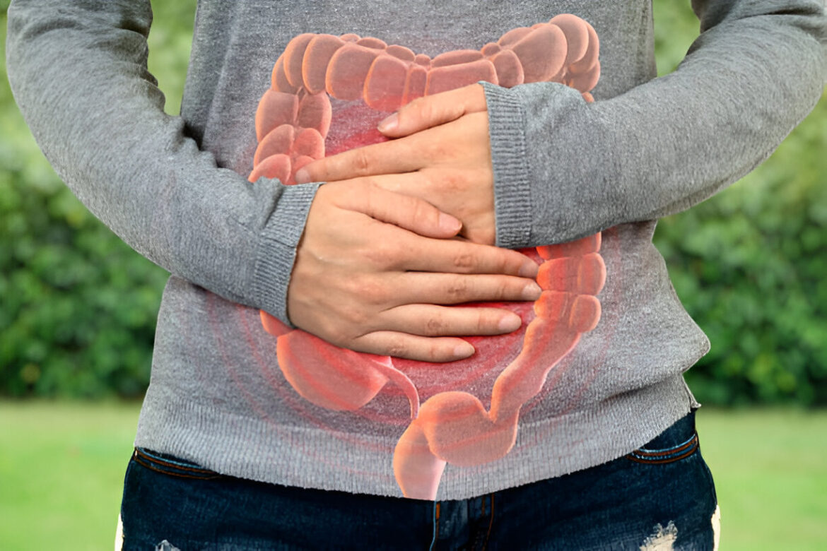 Viens no korektiem un latviešu valodā lietotiem nosaukumiem vārdam “kolitas” ir **resnās zarnas iekaisums**.

Atkarībā no konteksta (piemēram, ja tā ir diagnoze vai apzīmē konkrētu slimību), lieto:

– **Kolīts**  
vai  
– **Resnās zarnas iekaisums**

Piemēri lietojumā:
– “Pacientam konstatēts kolīts.”
– “Slimnīcā ārstē resnās zarnas iekaisumu.”