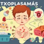 toksoplazmozė