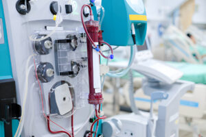 ECMO