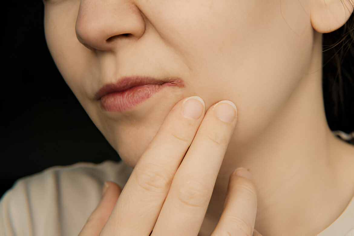 Kampas dermatīts: simptomi, cēloņi, ārstēšana