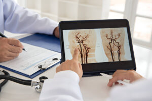 Magnetinio rezonanso angiografija