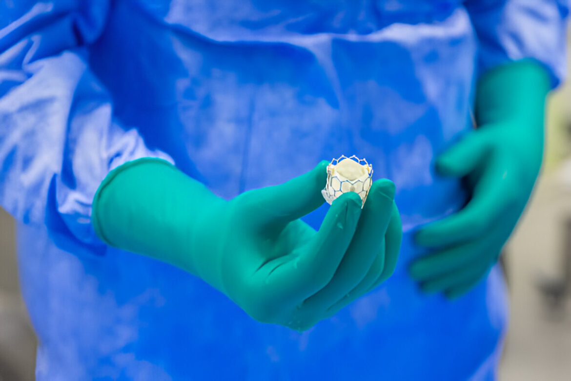 Transkatetru aortas vārstuļa implantācija: kas jāzina?
