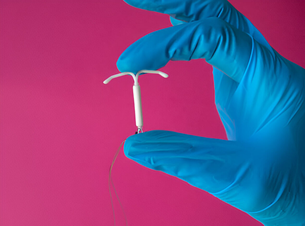 Mirena – hormonālā intrauterīnā spirāle

Ja nepieciešams vēl dabiskāks variants, ko lieto veselības nozarē, var:

Mirena – hormonālā dzemdes spirāle