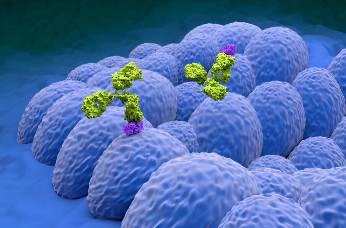 Endometrija vēzis: simptomi, diagnostika un ārstēšana