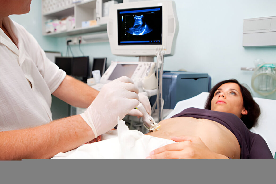 Aknu biopsija: precīza metode slimību diagnostikā