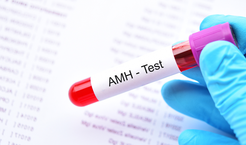 Antimileru hormona (AMH) tests