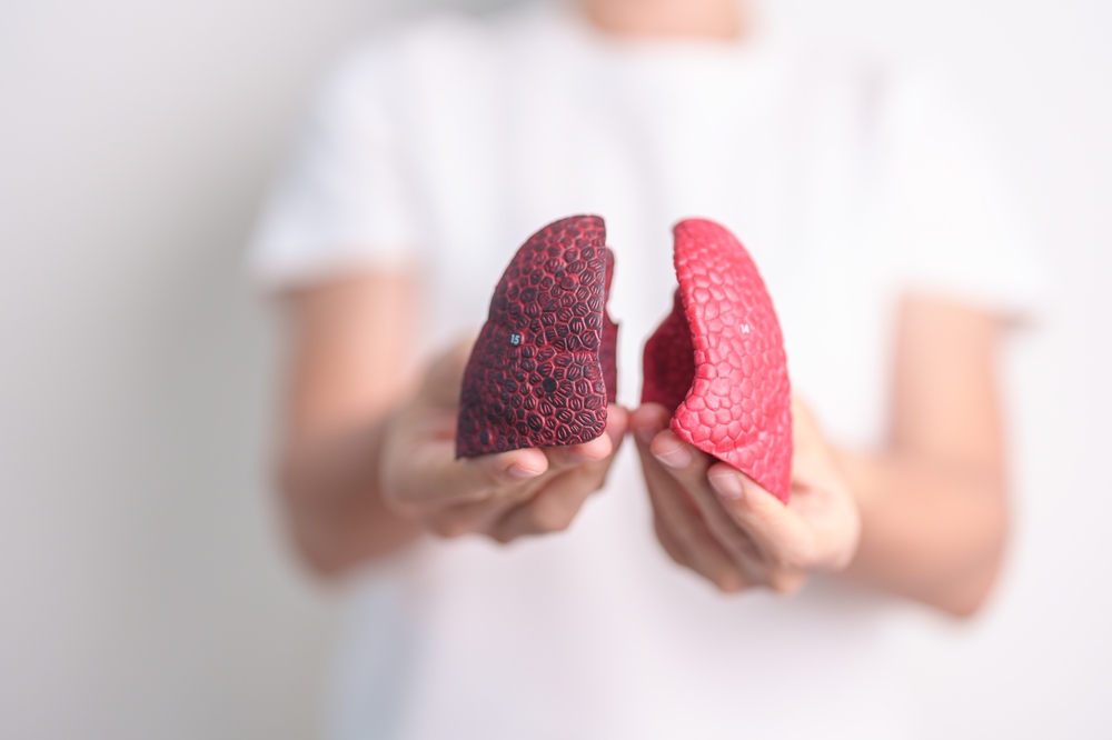 Plaušu fibroze: simptomi, cēloņi un ārstēšana